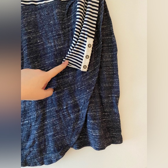 Anthropologie Mixed Fabric Dress - Picture 7 of 9